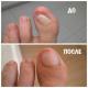 Грибок ногтей: признаки, симптомы, лечение